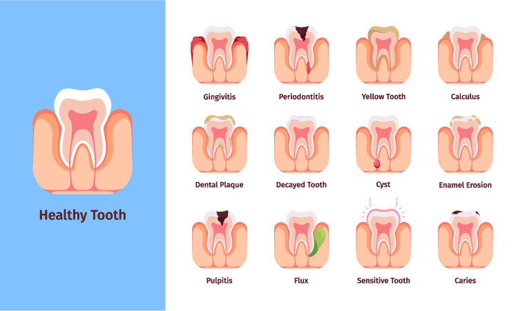 Infographic - Dental