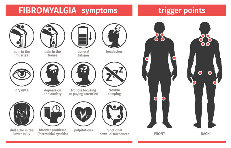 Infographic - Fibromyalgia